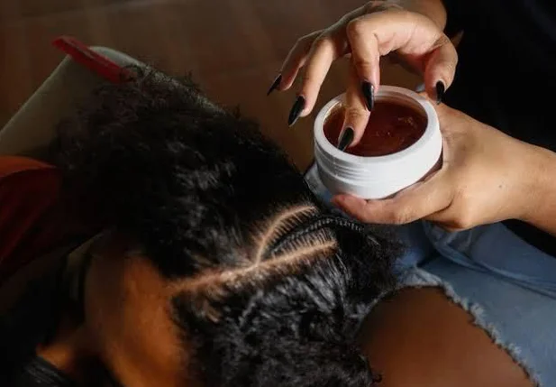 Casos de queimaduras nos olhos aumentam devido ao uso de pomadas